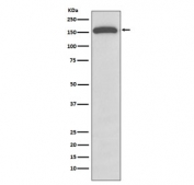 Western blot testing of human A549 cell lysate with GLI1 antibody. Expected molecular weight: 100~160 kDa.