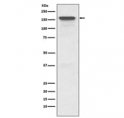 Western blot testing of human HeLa cell lysate with MDR1 antibody. Expected molecular weight: 141-180 kDa depending on glycosylation level.