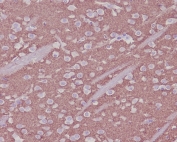 IHC staining of FFPE mouse brain tissue with Synaptophysin antibody. HIER: boil tissue sections in pH6, 10mM citrate buffer, for 10-20 min and allow to cool before testing.