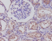 IHC staining of FFPE human kidney tissue with SYP antibody. HIER: boil tissue sections in pH6, 10mM citrate buffer, for 10-20 min and allow to cool before testing.