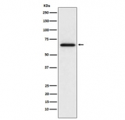 Western blot testing of rat L6 cell lysate with MMP2 antibody. Expected molecular weight: ~72 kDa (pro form), ~63 kDa (cleaved form).
