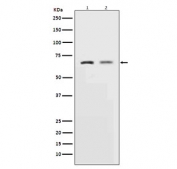 Western blot testing of 1) rat L6 and 2) human HeLa cell lysate with MMP2 antibody. Expected molecular weight: ~72 kDa (pro form), ~63 kDa (cleaved form).