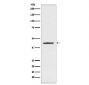 Western blot testing of human HepG2 cell lysate with HMBS antibody. Predicted molecular weight ~39 kDa.
