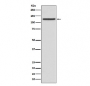 Western blot testing of human fetal liver lysate with CD41 antibody. Expected molecular weight ~120 kDa (alpha chain) and ~23 kDa (beta chain).