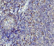 IHC staining of FFPE human tonsil with APOBEC3G antibody. HIER: boil tissue sections in pH8 EDTA for 20 min and allow to cool before testing.