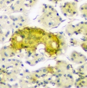 IHC staining of FFPE human pancreas with ATP Citrate Lyase antibody. HIER: boil tissue sections in pH8 EDTA for 20 min and allow to cool before testing.