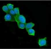 Immunofluorescent staining of FFPE human MCF7 cells with ATP Citrate Lyase antibody (green) and DAPI nuclear stain (blue). HIER: steam section in pH6 citrate buffer for 20 min.