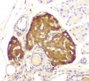 IHC staining of FFPE mouse pancreas with ATP Citrate Lyase antibody. HIER: boil tissue sections in pH8 EDTA for 20 min and allow to cool before testing.