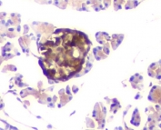IHC staining of FFPE rat pancreas with ATP Citrate Lyase antibody. HIER: boil tissue sections in pH8 EDTA for 20 min and allow to cool before testing.