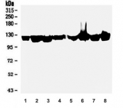 Western blot testing of human 1) placenta, 2) U-87 MG, 3) HEK293, 4) Caco-2, 5) HL-60, 6) Raji, 7) ThP-1 and 8) PANC-1 lysate with ATP Citrate Lyase antibody. 