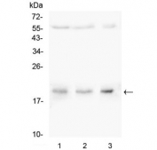 Western blot testing of 1) rat thymus, 2) rat lung and 3) mouse SP20 lysate with CDC42 antibody. Predicted molecular weight ~21 kDa.