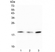 Western blot testing of human 1) U-87 MG, 2) K562 and 3) HeLa cell lysate with CDC42 antibody. Predicted molecular weight ~21 kDa.