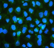 Immunofluorescent staining of FFPE human A431 cells with Ch-TOG antibody (green) and DAPI nuclear stain (blue). HIER: boil tissue sections in pH6, 10mM citrate buffer, for 20 min and allow to cool before testing.