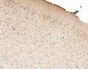 IHC staining of FFPE mouse brain with Ch-TOG antibody. HIER: boil tissue sections in pH6, 10mM citrate buffer, for 20 min and allow to cool before testing.