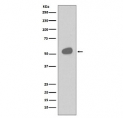 Western blot testing of human tonsil lysate with CD14 antibody. Expected molecular weight 40-55 kDa depending on glycosylation level.