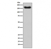 Western blot testing of human plasma lysate with Complement Factor H antibody. Predicted molecular weight ~139 kDa but may be observed at a higher molecular weight due to glycosylation.