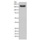 Western blot testing of human plasma lysate with Complement Factor H antibody. Predicted molecular weight ~139 kDa but may be observed at a higher molecular weight due to glycosylation.
