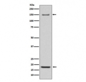 Western blot testing of mouse heart lysate with ITGA5 antibody. Expected molecular weight: 115-160 kDa depending on glycosylation level. An ~25 kDa band corresponding to the ITGA5 light chain may also be detected.