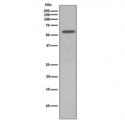 Western blot testing of lysate from Calyculin A-treated HeLa cells with phospho-Vimentin antibody (pS72). Expected molecular weight: 53-58 kDa.