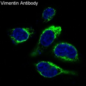 Immunofluorescent staining of human HeLa cells with VIM antibody (green) and DAPI nuclear stain (blue).