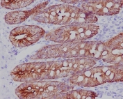 IHC staining of FFPE rat colon tissue with Cytokeratin 19 antibody. HIER: boil tissue sections in pH6, 10mM citrate buffer, for 10-20 min and allow to cool before testing.