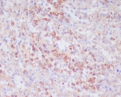 IHC staining of FFPE human spleen tissue with CD63 antibody. HIER: boil tissue sections in pH6, 10mM citrate buffer, for 10-20 min and allow to cool before testing.