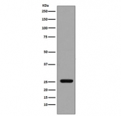 Western blot testing of human recombinant protein with GST pi antibody. Predicted molecular weight ~23 kDa.