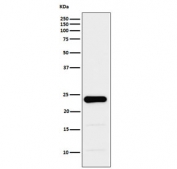 Western blot testing of human PC-3 cell lysate with GSTP1 antibody. Predicted molecular weight ~23 kDa.
