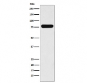 Western blot testing of human Caco-2 cell lysate with VIL1 antibody. Predicted molecular weight ~93 kDa.