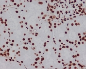 IHC staining of FFPE human kidney tissue with HMGB1 antibody. HIER: boil tissue sections in pH6, 10mM citrate buffer, for 10-20 min and allow to cool before testing.