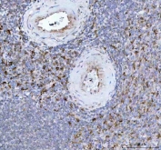 IHC staining of FFPE human spleen tissue with Heme Oxygenase 1 antibody. HIER: boil tissue sections in pH8 EDTA buffer for 10-20 min and allow to cool before testing.