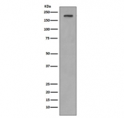 Western blot testing of human SH-SY5Y cell lysate with PDGFRB antibody. Expected molecular weight: 123-190 kDa depending on level of glycosylation.