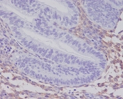 IHC staining of FFPE human uterus tissue with PDGFRB antibody. HIER: boil tissue sections in pH6, 10mM citrate buffer, for 10-20 min and allow to cool before testing.