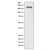 Western blot testing of lysate from PDGF-treated mouse NIH3T3 cells with phospho-PDGFRB antibody (pY740). Expected molecular weight: 123-190 kDa depending on level of glycosylation.
