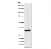 Western blot testing of human HepG2 cell lysate with HNRNPA1 antibody. Expected molecular weight: ~34 and/or 39 kDa.