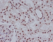 IHC staining of FFPE human kidney tissue with Cleaved PARP antibody. HIER: boil tissue sections in pH6, 10mM citrate buffer, for 10-20 min and allow to cool before testing.