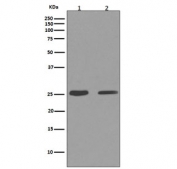 Western blot testing of mouse 1) RAW264 and 2) NIH3T3 cell lysate with Cleaved PARP antibody. Predicted molecular weight ~24 kDa (DNA-binding domain).