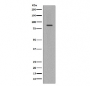 Western blot testing of human Jukat cell lysate with Cleaved PARP antibody. Predicted molecular weight ~89 kDa (auto-modification/catalytic domain).