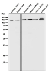 PARP1 Antibody Mouse Tissue WB. Western blot analysis of mouse heart, liver, lung, kidney, brain, and skin tissue lysates using recombinant rabbit monoclonal PARP1 antibody clone CFD-16 at 1:1000 dilution for 1 hour at room temperature. Lane 1: mouse heart lysate, Lane 2: mouse liver lysate, Lane 3: mouse lung lysate, Lane 4: mouse kidney lysate, Lane 5: mouse brain lysate, Lane 6: mouse skin lysate. A prominent band is detected near 113 kDa across all tested tissues, consistent with the predicted molecular weight of PARP1. The broad tissue distribution supports the role of this chromatin-associated DNA repair enzyme in genomic stability maintenance, nuclear stress surveillance, and DNA strand break signaling across metabolically active and proliferative mouse tissues.