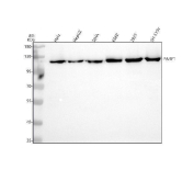 PARP1 Antibody Multi-Cell Line WB. Western blot analysis of human HeLa, HepG2, SIHA, K562, 293T, and SH-SY5Y whole cell lysates using recombinant rabbit monoclonal PARP1 antibody clone CFD-16. Lane 1: human HeLa lysate, Lane 2: human HepG2 lysate, Lane 3: human SIHA lysate, Lane 4: human K562 lysate, Lane 5: human 293T lysate, Lane 6: human SH-SY5Y lysate. A strong band is detected near 113 kDa across all tested samples, consistent with the predicted molecular weight of PARP1. The broad detection pattern supports the widespread expression of this chromatin-associated DNA repair enzyme involved in genomic stability maintenance, DNA strand break signaling, and nuclear stress response pathways across diverse human cell types.