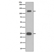 Western blot testing of human Jurkat cell lysate with PARP antibody. Predicted molecular weight ~116 kDa (full length), ~24 kDa (DNA-binding domain).