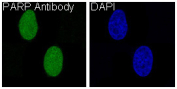 PARP1 Antibody HeLa IF. Immunofluorescence analysis of human HeLa cells using recombinant rabbit monoclonal PARP1 antibody clone CFD-16. PARP1 staining (green) demonstrates strong nuclear localization consistent with the chromatin-associated distribution of this DNA repair enzyme involved in genomic stability maintenance and DNA strand break response signaling. Nuclei are counterstained blue with DAPI.