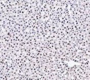 PARP1 Antibody Rat Liver IHC. Immunohistochemistry analysis of FFPE rat liver tissue using PARP1 Antibody / Chromatin Repair Protein Antibody. Hepatocyte nuclei demonstrate diffuse HRP-DAB brown staining consistent with the chromatin-associated localization of PARP1 in DNA repair, genomic stability maintenance, and oxidative stress-response signaling pathways within metabolically active hepatic tissue. Nuclei are counterstained blue. Heat-induced epitope retrieval was performed using EDTA buffer, pH8.0, prior to staining.