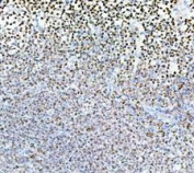 PARP1 Antibody Human Tonsil IHC. Immunohistochemistry analysis of FFPE human tonsil tissue using recombinant rabbit monoclonal PARP1 antibody clone CFD-16. Lymphoid cells demonstrate widespread nuclear HRP-DAB brown staining consistent with the role of PARP1 as a chromatin-associated DNA repair enzyme involved in genomic surveillance, stress-response signaling, and proliferative nuclear activity within immune cell populations. Nuclei are counterstained blue. Heat-mediated antigen retrieval was performed in pH8 EDTA buffer prior to staining.