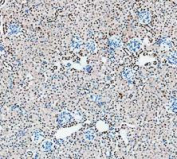 PARP1 Antibody Mouse Kidney IHC. Immunohistochemistry analysis of FFPE mouse kidney tissue using recombinant rabbit monoclonal PARP1 antibody clone CFD-16. Renal tubular epithelial cells and scattered interstitial cell populations demonstrate prominent nuclear HRP-DAB brown staining consistent with the chromatin-associated localization of PARP1 in DNA repair, genomic stability maintenance, and nuclear stress response signaling pathways. Nuclei are counterstained blue. Heat-mediated antigen retrieval was performed in pH8 EDTA buffer prior to staining.