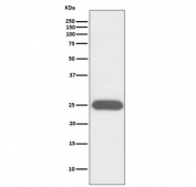 Western blot testing of human K562 cell lysate with G-CSF antibody. Predicted molecular weight ~22 kDa.