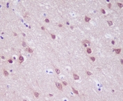 IHC staining of FFPE human brain tissue with PGP9.5 antibody. HIER: boil tissue sections in pH6 citrate buffer for 20 min and allow to cool before testing.