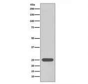 Western blot testing of human 293T cell lysate with UchL1 antibody. Predicted molecular weight ~25 kDa.