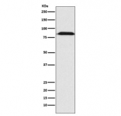 Western blot testing of human HepG2 cell lysate with Furin antibody. Expected molecular weight: 90-110 kDa depending on glycosylation level.