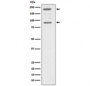 Western blot testing of human HepG2 cell lysate with C4A antibody. Predicted molecular weight: 193-203 kDa (C4A) and 93-98 kDa (C4A alpha chain).